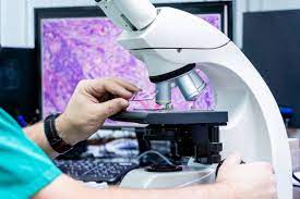 Tissue Sampling Biopsy
