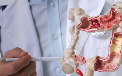 Colon Treatment